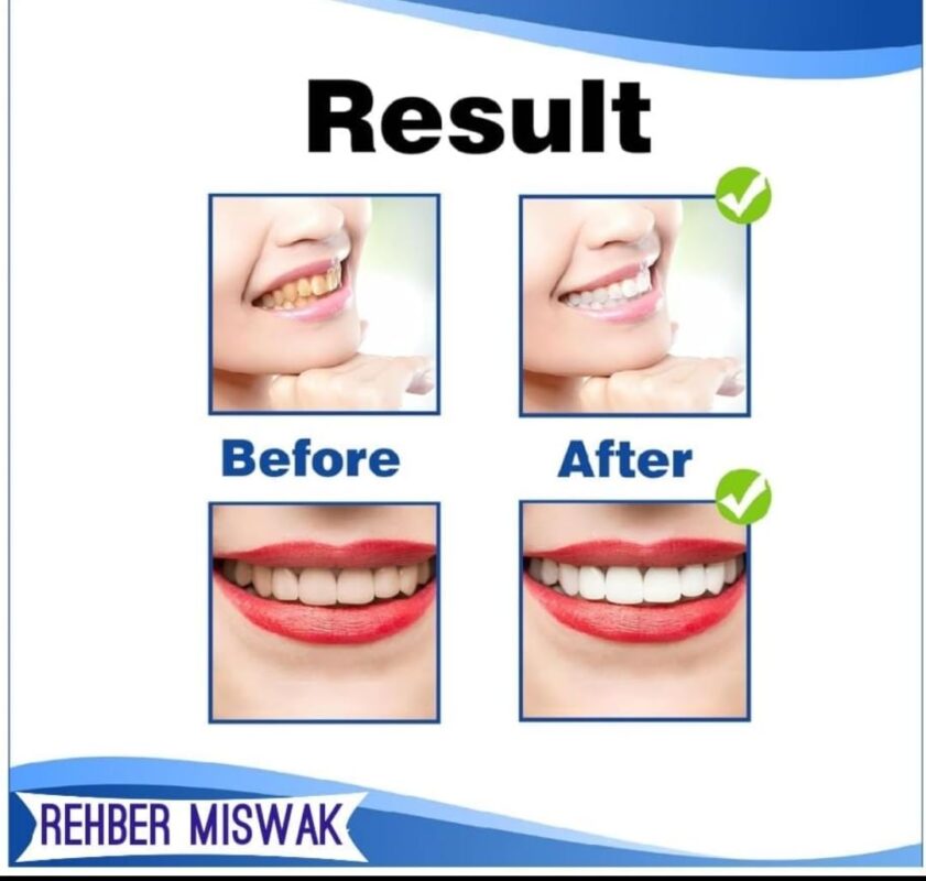 Result after Miswak